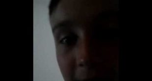 dillon can not eat dog food