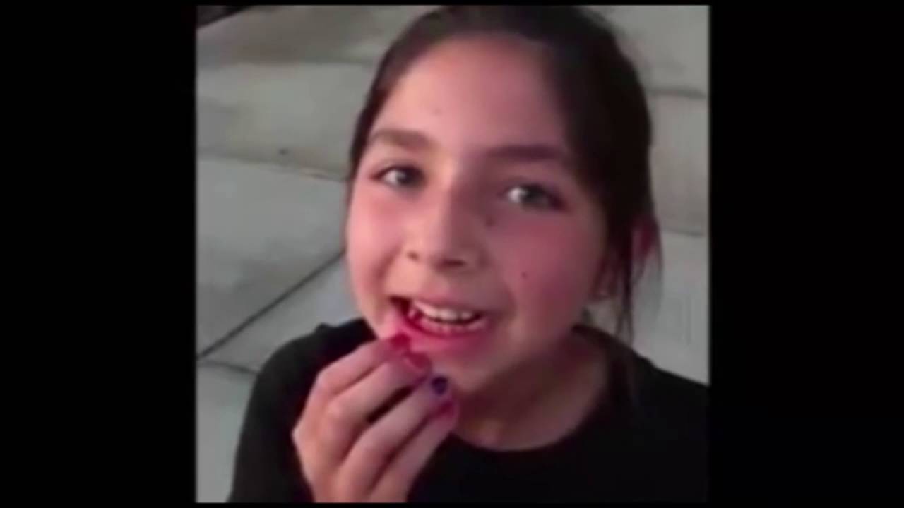 Dog Pulls 10-Year-Old Girl’s Loose Tooth [VIDEO]